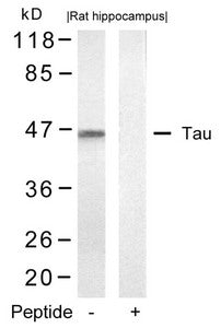 MAPT (Ab-422) Antibody