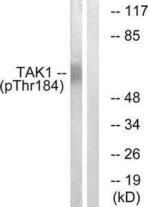 Phospho-MAP3K7 (Thr184) Antibody
