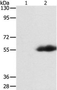 FLAG tag Antibody