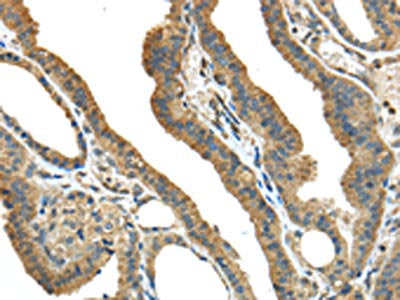 TMPRSS13 Antibody