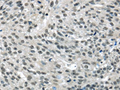 MED15 Antibody