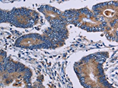 ITK Antibody