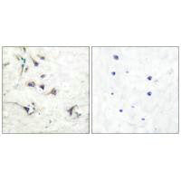 EZR Antibody