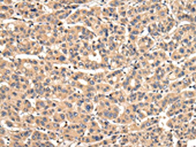 VPS35 Antibody