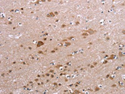 PPP2R3C Antibody