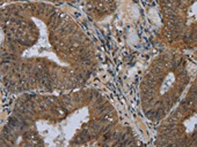 NAT10 Antibody