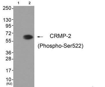 Phospho-DPYSL2 (Ser522) Antibody