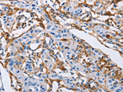 LAIR1 Antibody