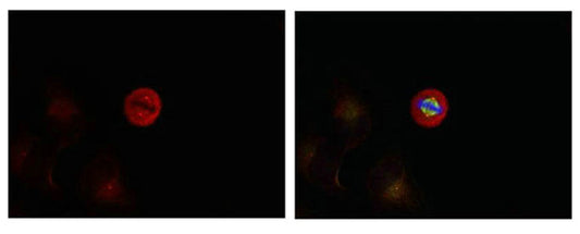 Phospho-MAPK3 (Tyr204) Antibody