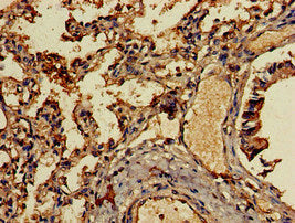 CCL13 Antibody