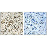 CIB2 Antibody