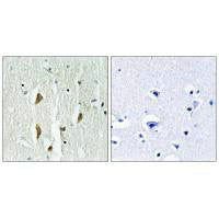 PAK1/PAK2/PAK3 (Ab-423/402/421) Antibody