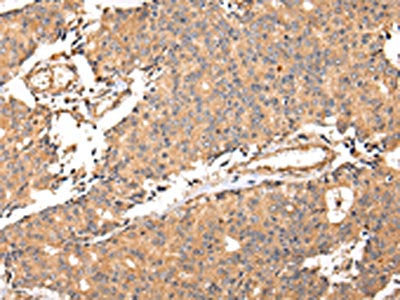 ALDH3A2 Antibody