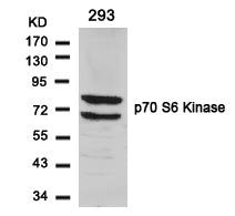 RPS6KB1 (Ab-424) Antibody