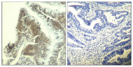 CDK6 (Ab-13) Antibody