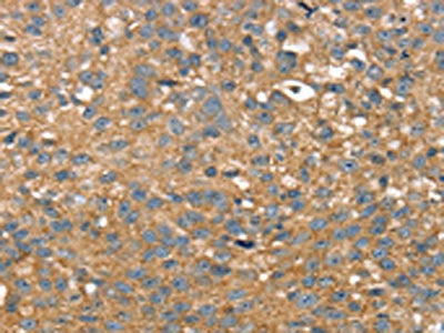 TWF1 Antibody