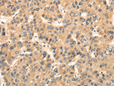 TTC23 Antibody