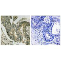 ALDOC Antibody