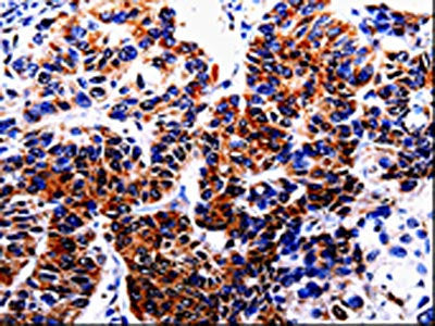HTR2B Antibody