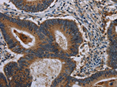 MAP3K11 Antibody