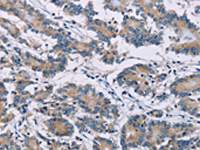 ODF2 Antibody