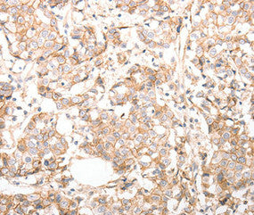 CDH23 Antibody