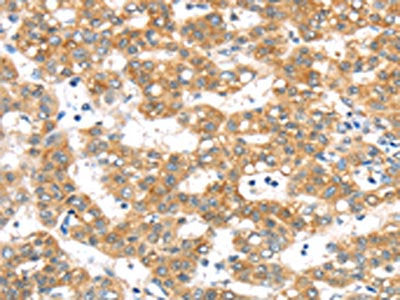 PTPN4 Antibody