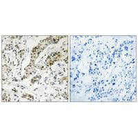TCEAL3/TCEAL5/TCEAL6 Antibody