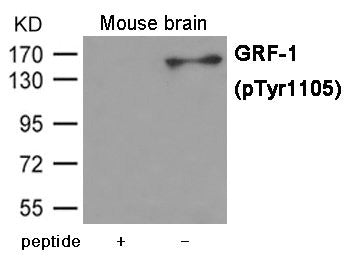 Phospho-ARHGAP35 (Tyr1105) Antibody