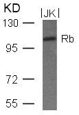 RB1 (Ab-780) Antibody