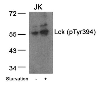Phospho-LCK (Tyr394) Antibody