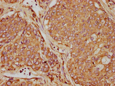 OSM Antibody