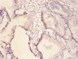 ERBB2 Antibody