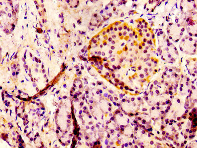 PTH Antibody