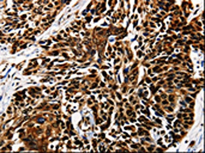 AKT1 Antibody