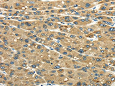 UGT2B4 Antibody