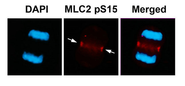 Phospho-MYL9 (Ser15) Antibody