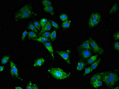 LDLR Antibody