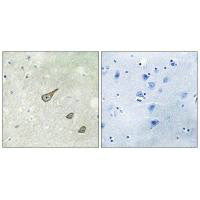 DGKK Antibody
