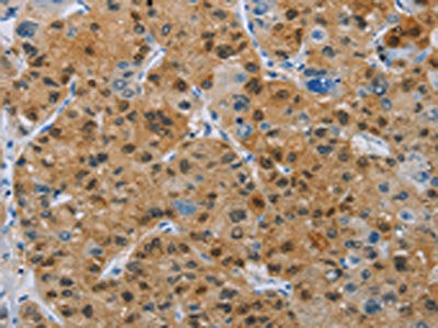 BTLA Antibody