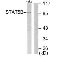 STAT5B (Ab-731) Antibody