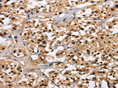 CARD8 Antibody