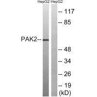 PAK2 (Ab-192) Antibody