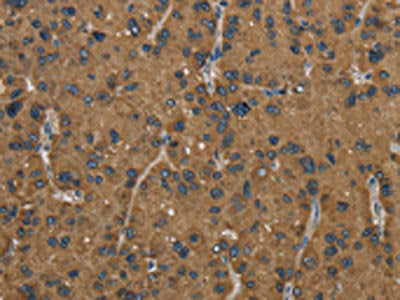 HSD17B2 Antibody