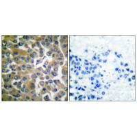 FAP Antibody