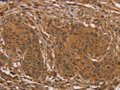 PRC1 Antibody