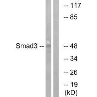 SMAD3 (Ab-204) Antibody