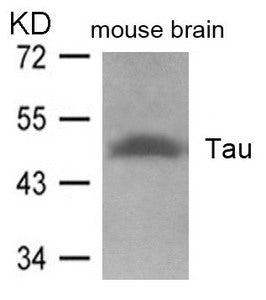 MAPT (Ab-262) Antibody