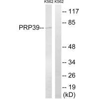 PRPF39 Antibody