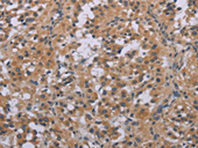 ACVR2A Antibody